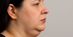 డబుల్ చిన్ వచ్చిందా.. రోజూ 5 నిమిషాలు ఈ ఫేస్ యోగా చేస్తే సరి!